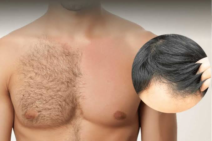 Hair transplant procedure close-up