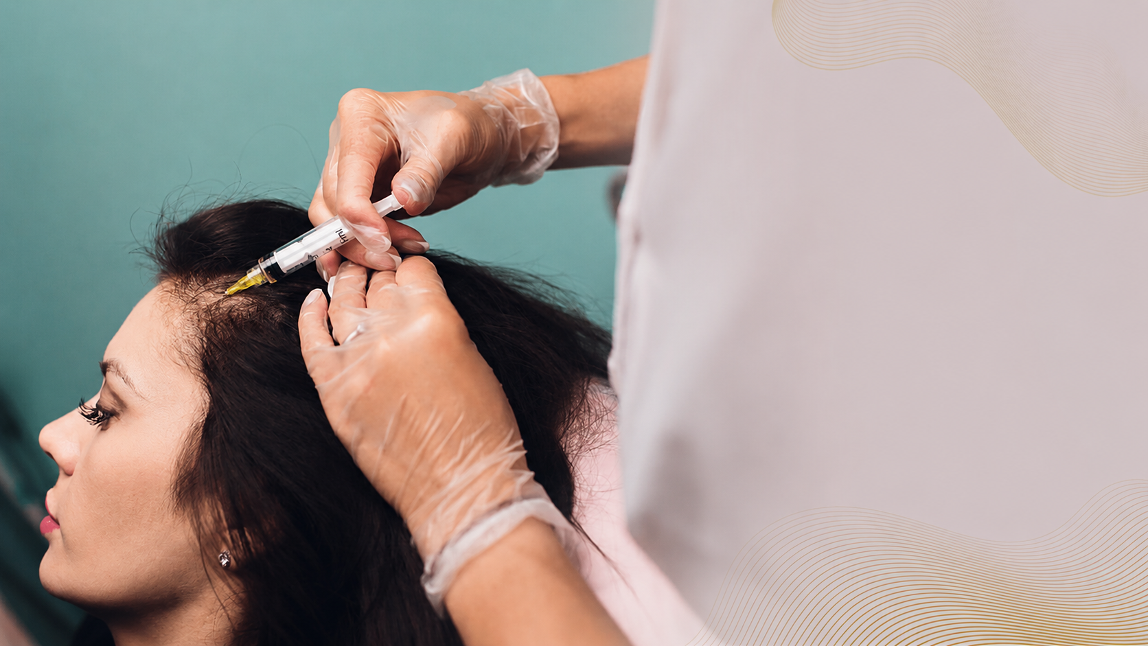 PRP Treatment for Hair Loss